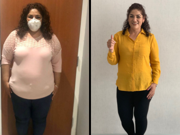 mujer antes y despues de perder peso