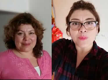 Mujer antes y después de Cirugía Bariátrica