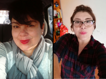 mujer antes y despues de  Cirugía Bariátrica